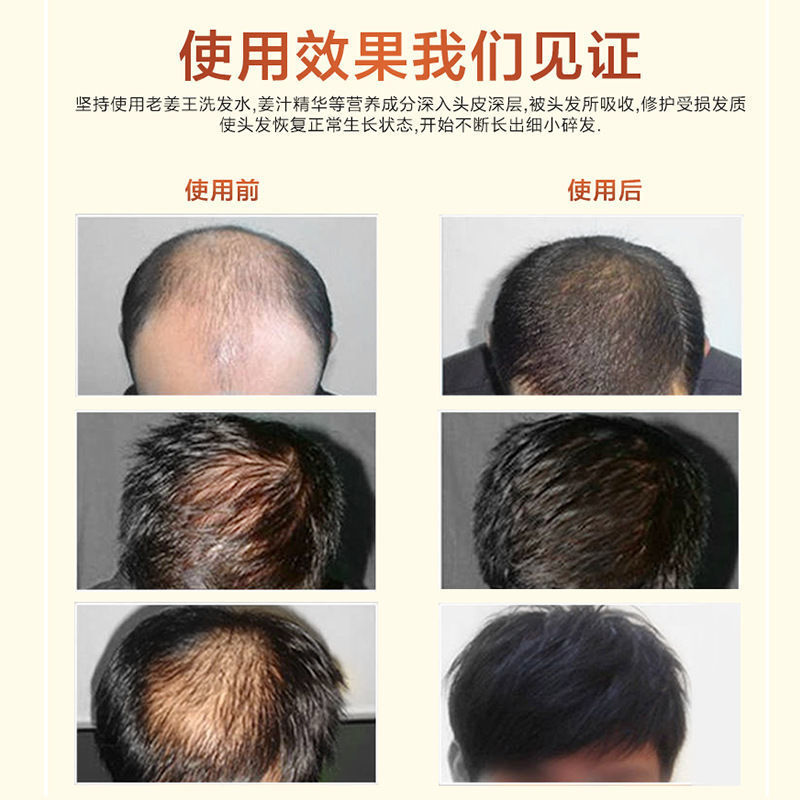 生姜防脱洗发水老姜王生发洗发露控油去屑育发生发防脱发