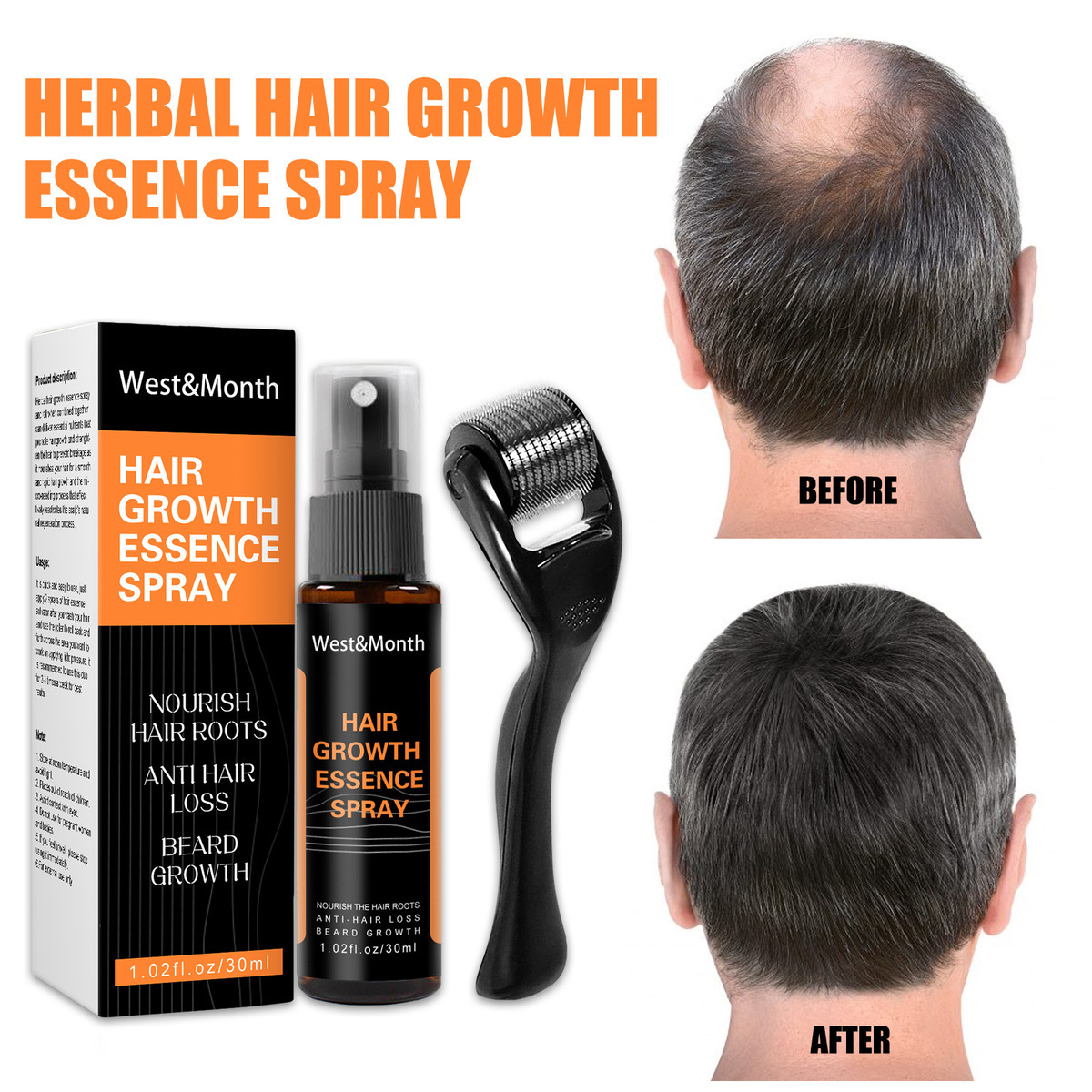Polygonum multiflorum anti caduta dei capelli Spray allo zenzero per capelli soluzione per la cura dell'attaccatura dei capelli spessi 2024_voghion.com