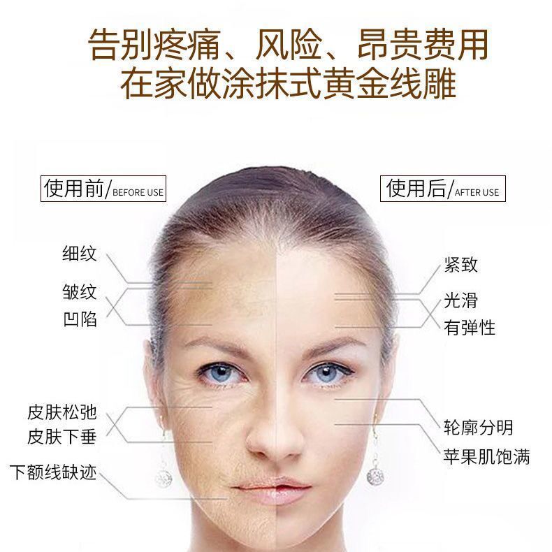 gpt黄金线雕蛋白线提拉紧致淡化细纹皱纹精华黄金液美容院专用