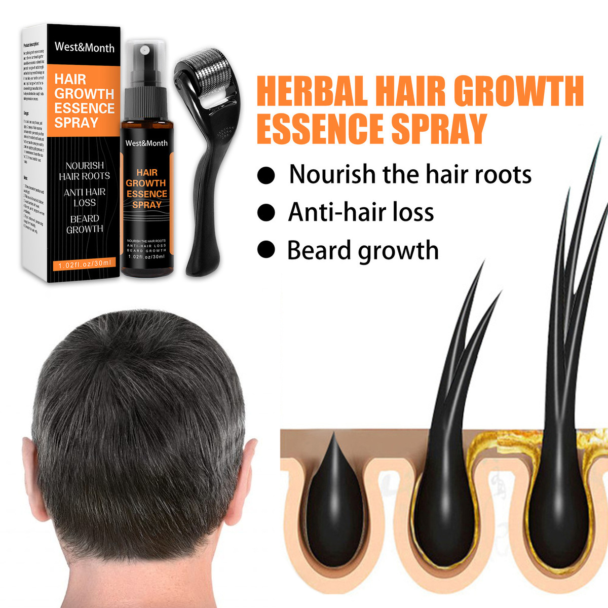 Polygonum multiflorum anti caduta dei capelli Spray allo zenzero per capelli soluzione per la cura dell'attaccatura dei capelli spessi 2024_voghion.com