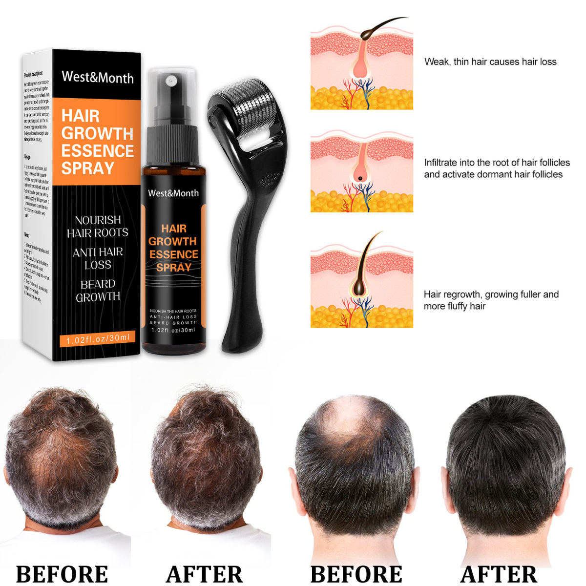Polygonum multiflorum anti caduta dei capelli Spray allo zenzero per capelli soluzione per la cura dell'attaccatura dei capelli spessi 2024_voghion.com