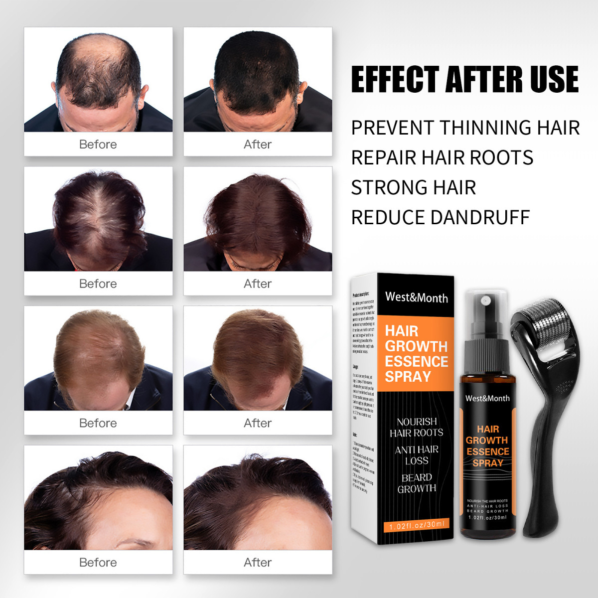 Polygonum multiflorum anti caduta dei capelli Spray allo zenzero per capelli soluzione per la cura dell'attaccatura dei capelli spessi 2024_voghion.com